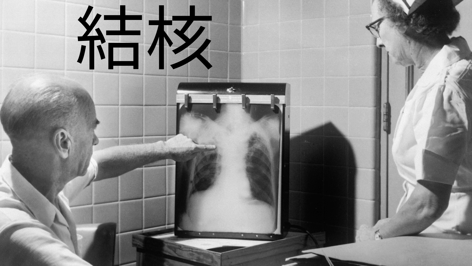 結核